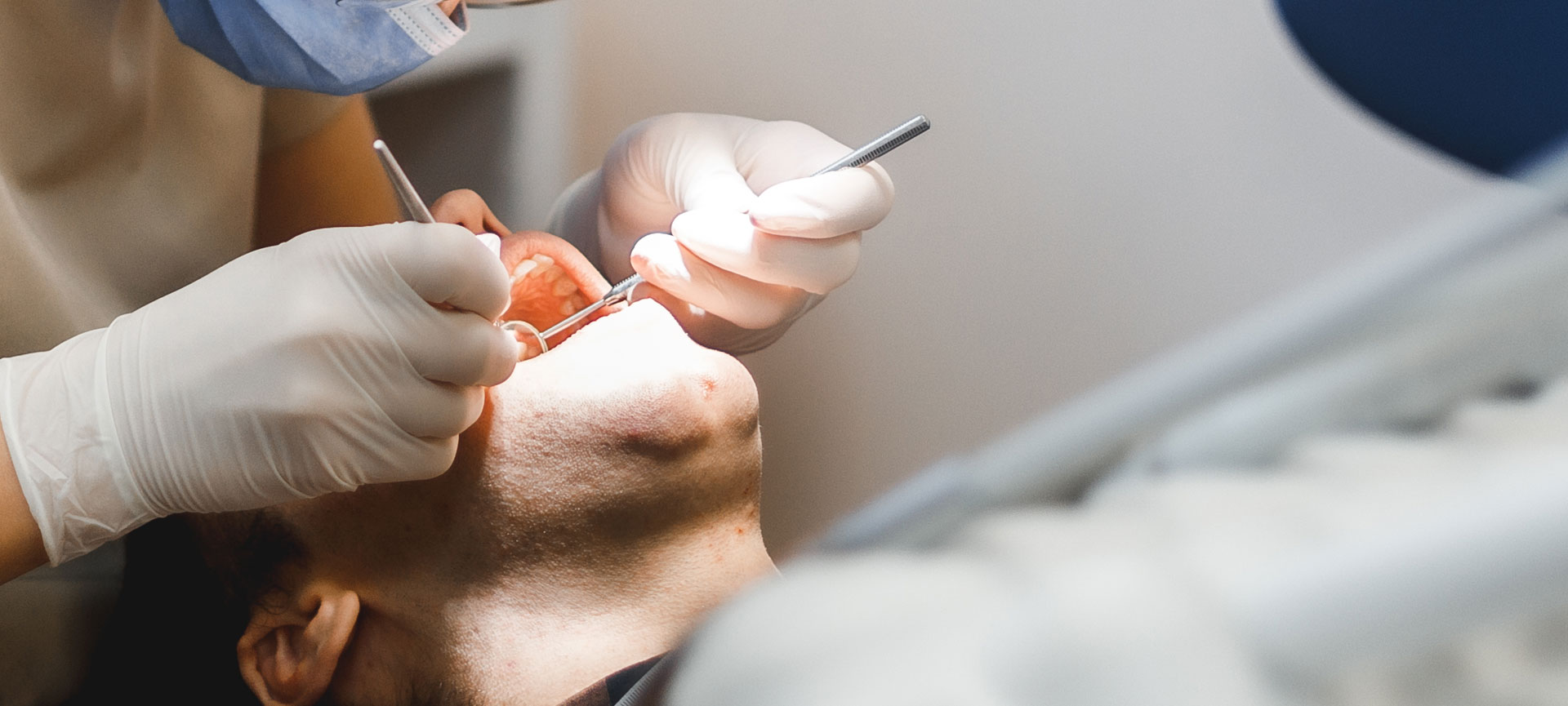 Fillings Putney Expert Dental Practice Wandsworth